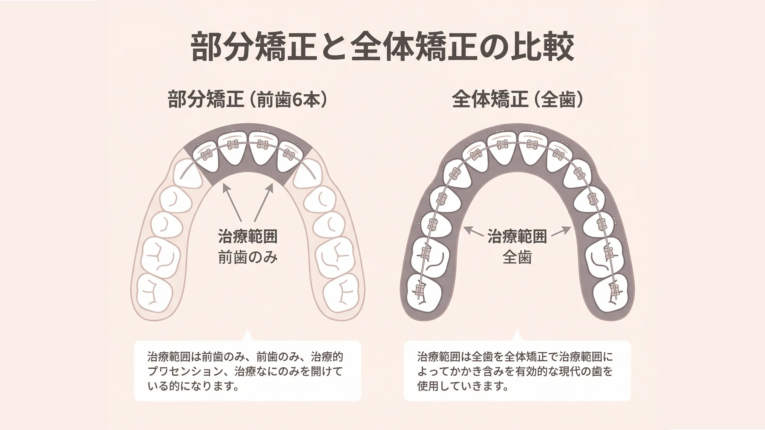 部分矯正と全体矯正の比較画像