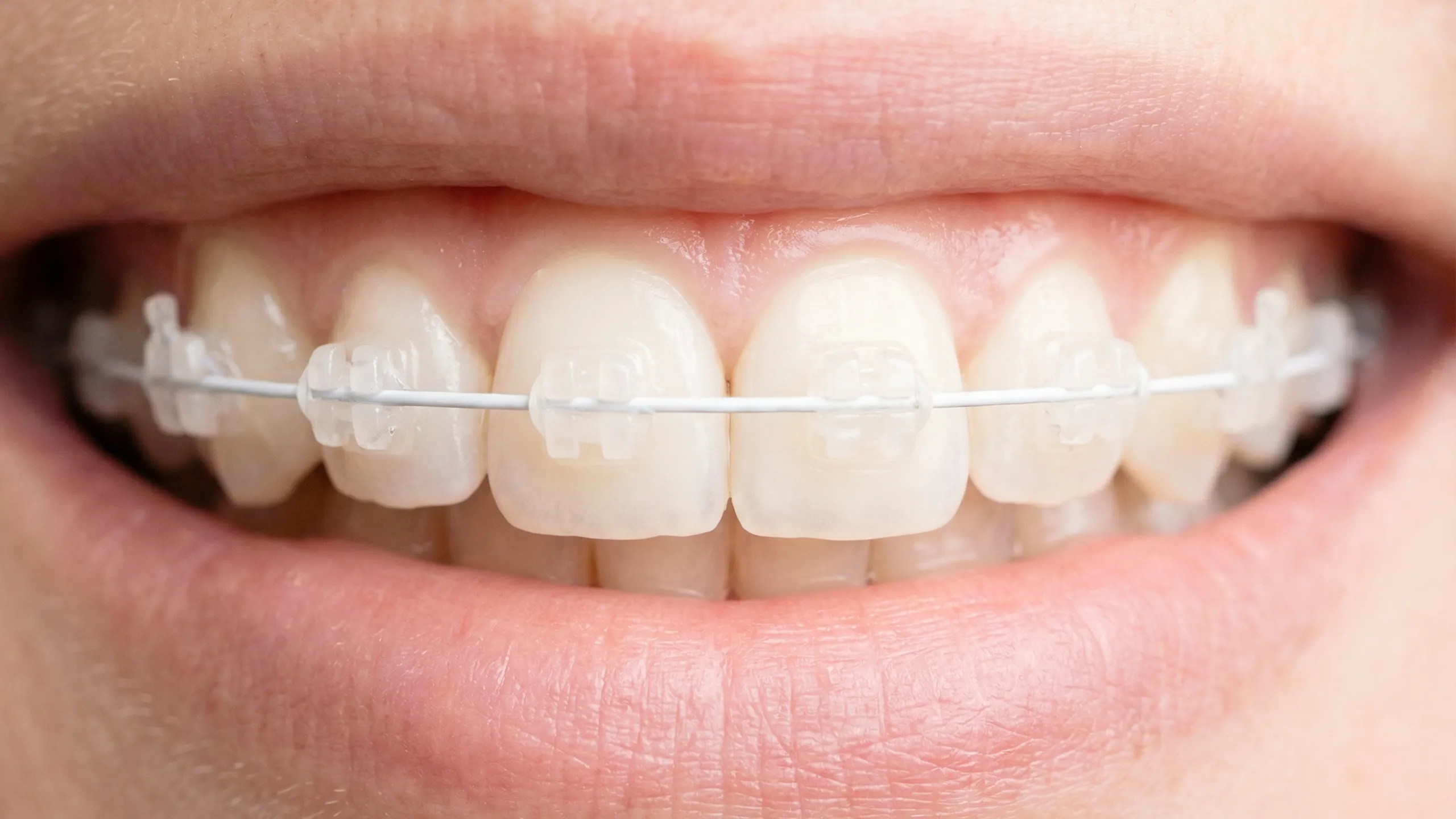 部分矯正イメージ画像