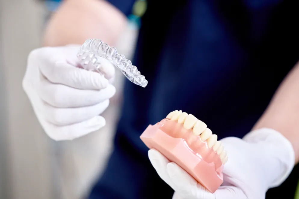 マウスピース矯正