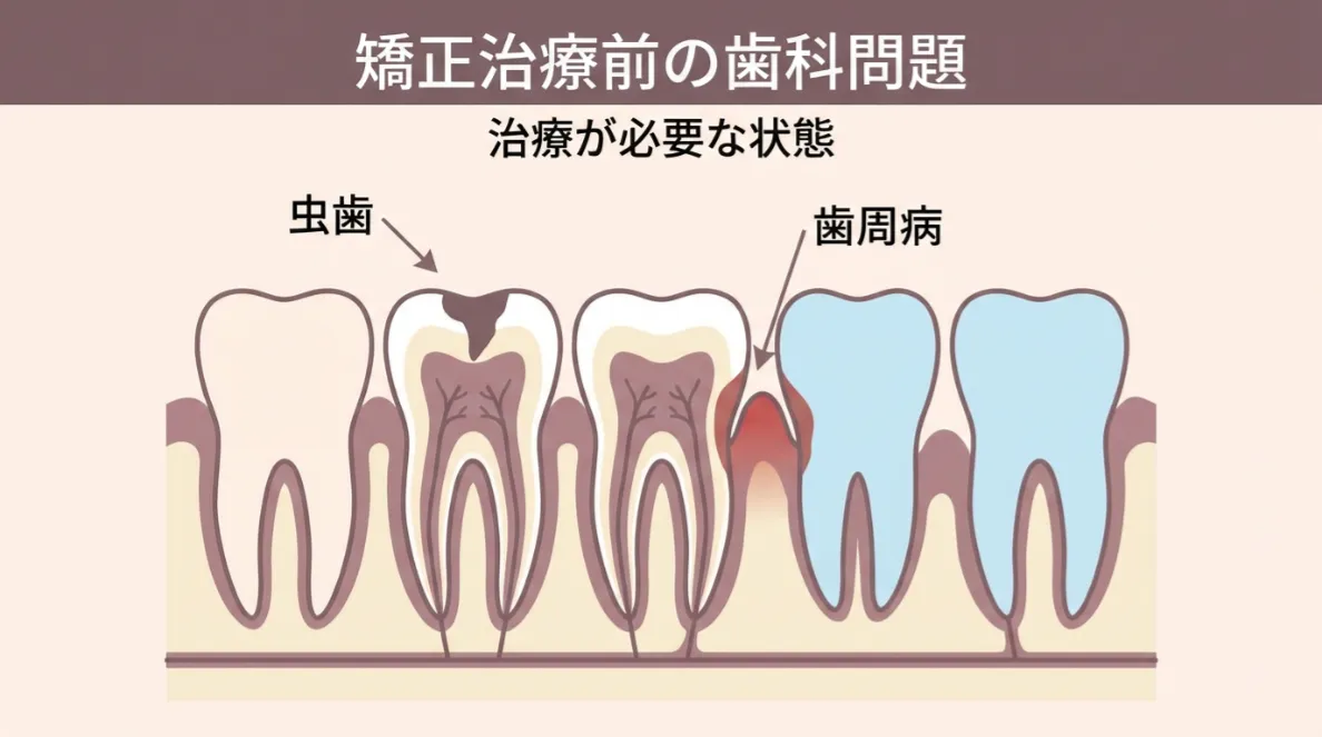 歯周病や虫歯が進行している方